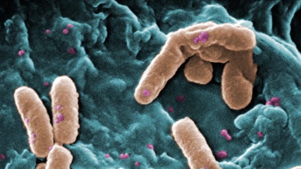 Bacteria-Pseudomonas-aeruginosa-superbug